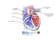 Critical PS And PA IVS Online Supplement